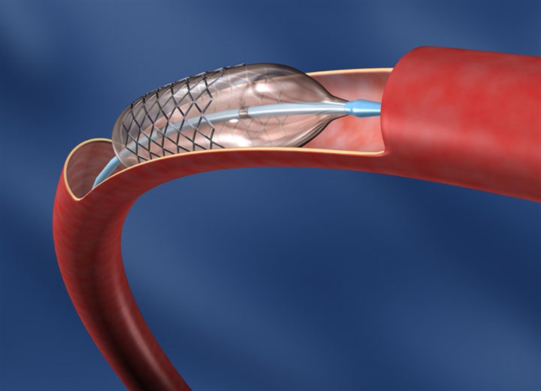 الترطيب في مجال تصنيع الأجهزة الطبية